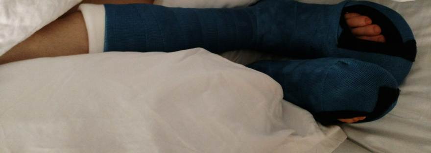 legs with 2 blue 1/2 leg casts