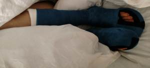 legs with 2 blue 1/2 leg casts